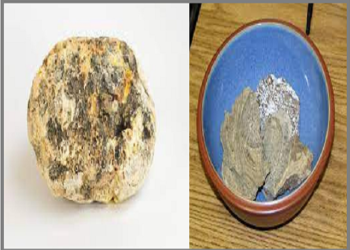 अंदाजे पाच कोटींच्या व्हेल माशाची उलटी तस्करी करणाऱ्या इसमास अटक