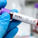 कोरोनानंतर आता स्वाईन फ्लूचा कहर; H1N1 बाधितांचा आकडा ३००० पार!
