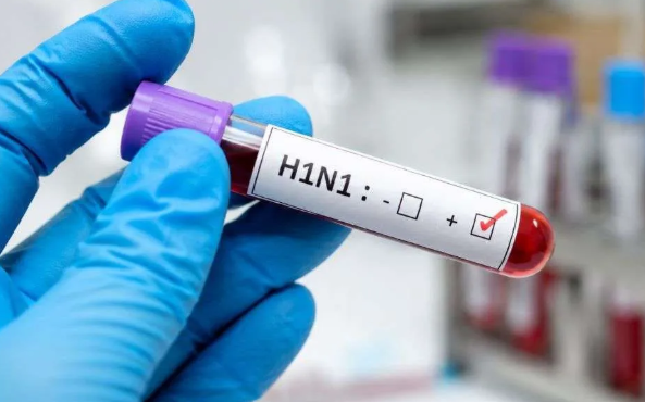 कोरोनानंतर आता स्वाईन फ्लूचा कहर; H1N1 बाधितांचा आकडा ३००० पार!
